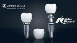 インプラントの種類