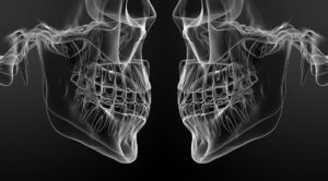 噛み合わせの重要性