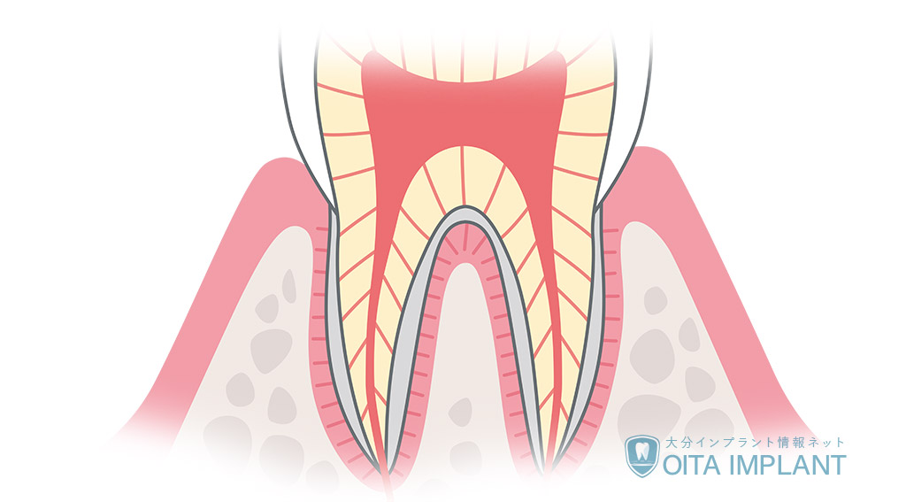 歯の神経について
