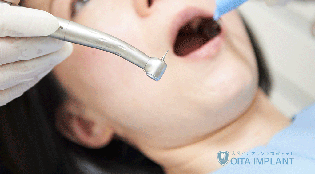歯科治療が1回で終わらないのはなぜ？