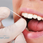 定期的に歯のクリーニングをおこないましょう