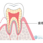 歯根膜とは